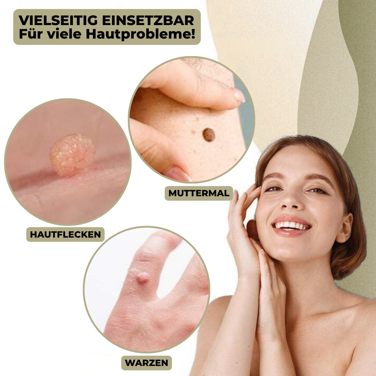Dayhills | DermaLinx Wart Remover | Pain-Free Removal of Warts & Moles | For Home | Without Surgery