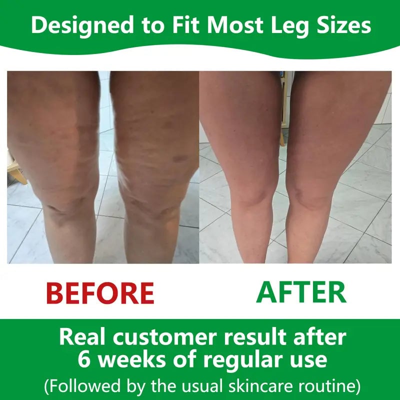 Dayhills | Sakerplus Cellulite Massage Roller