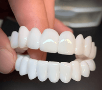 SmileFlex Dental Prosthesis with White Veneers